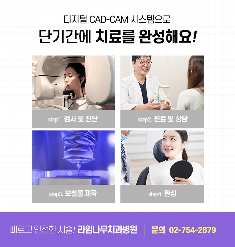 라미네이트 치료, 신중한 결정이 중요합니다 관련 이미지 6