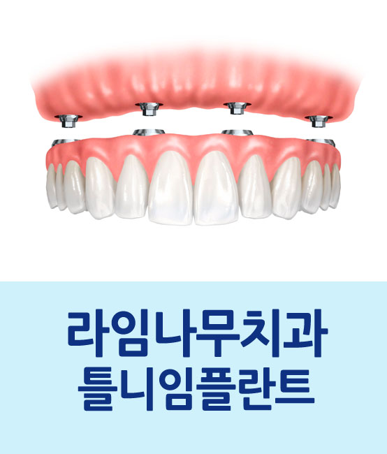 임플란트 틀니를 고려중이시라면 관련 이미지 1