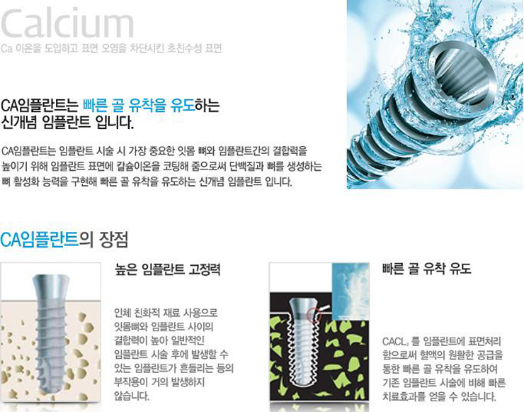 임플란트는? 라임나무치과만의 특화 임플란트 관련 이미지 10