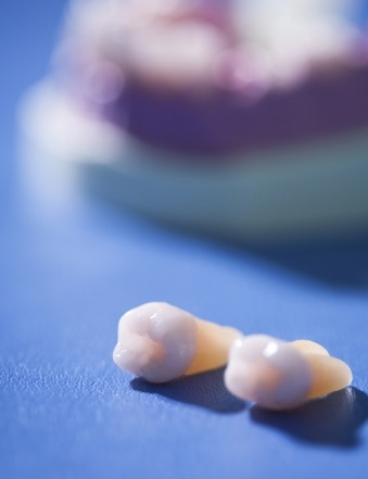 자연치아를 살리는 합리적인 방법, 잇몸치료부터 하세요~ 관련 이미지 10