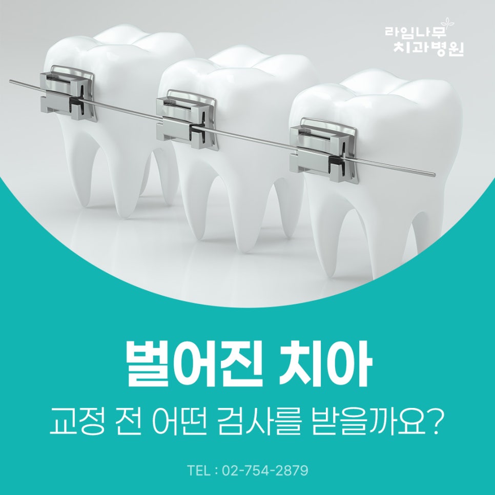 명동 치아교정 벌어진 치아, 치아교정 전 어떤 검사를 받을까요? 관련 이미지 2