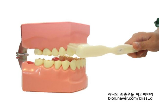 치아교정 중 칫솔질 하는 순서 관련 이미지 2