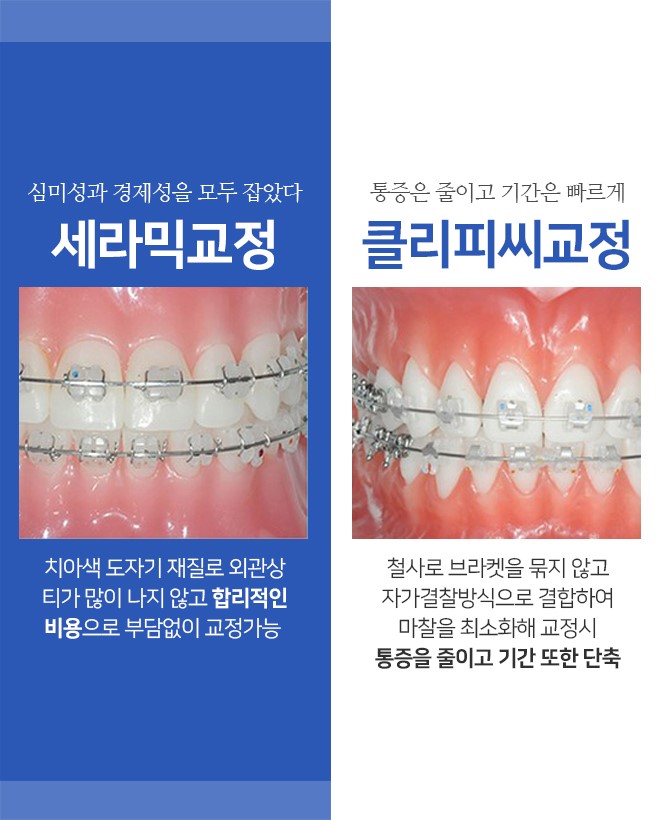 명동치과 치아교정 알아보고 계셨다면? 관련 이미지 2