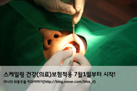 스케일링 건강(의료)보험적용 7월1일부터 시작! 관련 이미지 1