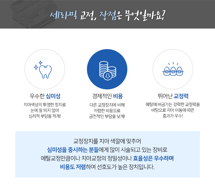 합리적 가격과 심미성을 모두 잡은 세라믹교정 관련 이미지 3