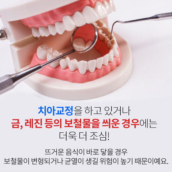 뜨거운 음식 삼계탕, 치아건강에는 좋지 않다? 이열치열 보양식 제대로 알아보자!!!! 관련 이미지 4