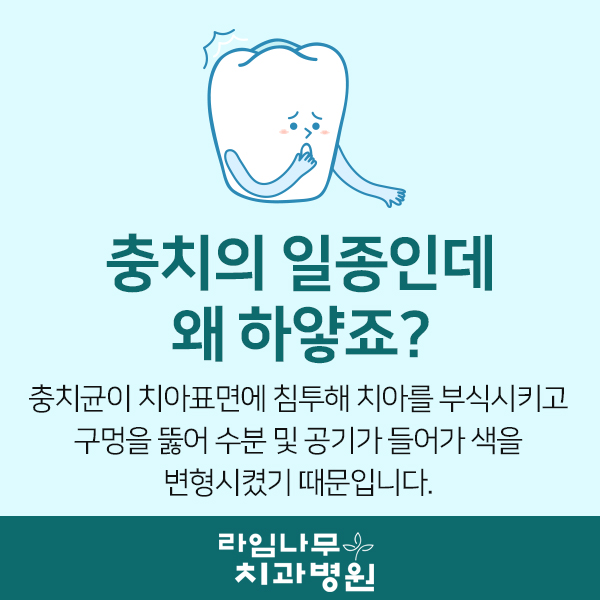 하얀충치? 치아탈회 그냥 두지마세요! 관련 이미지 3