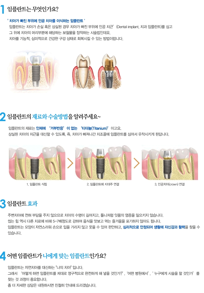 임플란트 고민, 잇몸뼈 재생 촉진하는 HA임플란트로 해결하세요 관련 이미지 2