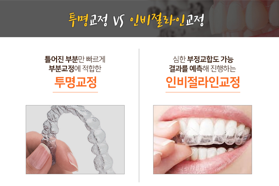 치아교정, 장치의 종류와 비용 알아보기 관련 이미지 4