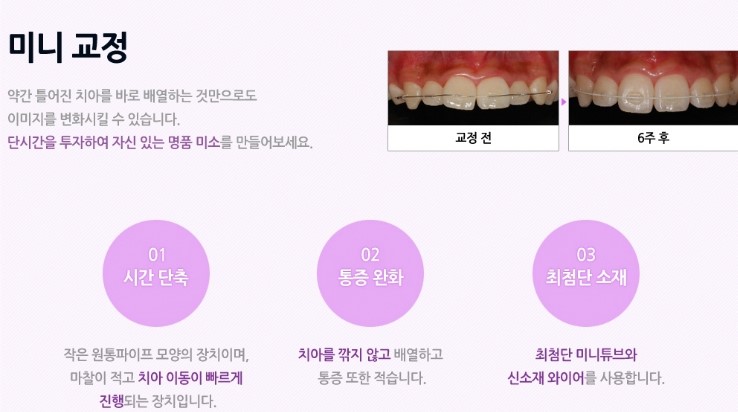 몰래 티 안나게 교정하고 싶은 마음, 시크릿 교정의 모든 것을 소개합니다 관련 이미지 5
