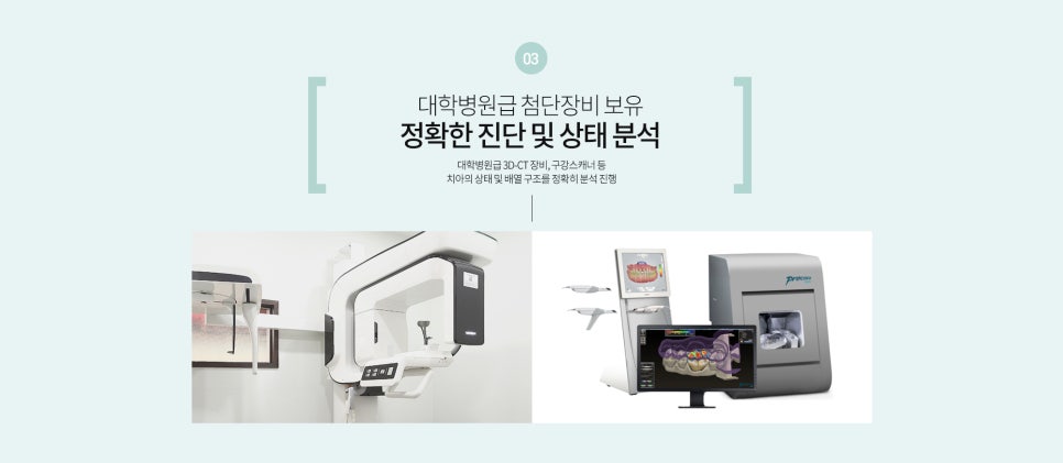 명동치과 클리피씨 교정 궁금하다면? 라임나무치과 관련 이미지 6