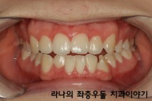 학생교정시 고려할 점은 무엇일까? 관련 이미지 3