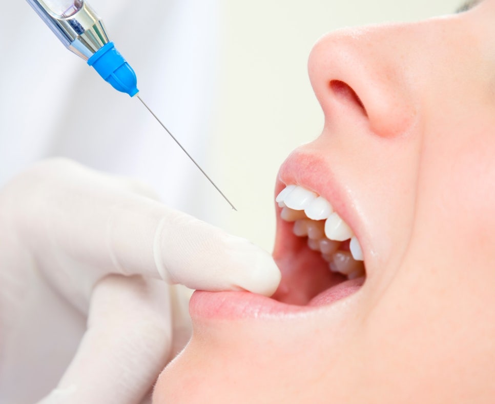 명동치과 신경치료후 통증이 더 심해졌어요! 신경치료 부작용? 플레어업(Flare up) 알아보기! 관련 이미지 3