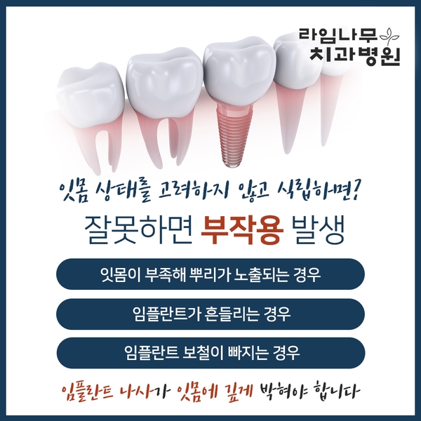 뼈이식임플란트 신중히 알아보자구요 관련 이미지 2