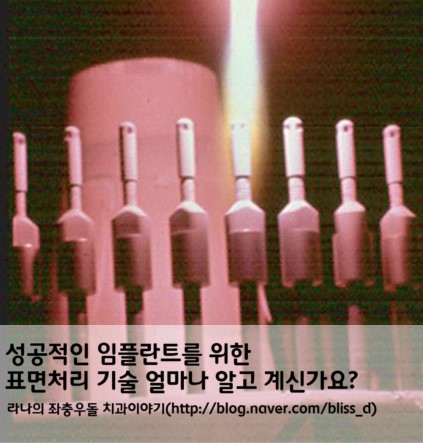 성공적인 임플란트를 위한 표면처리 기술 얼마나 알고 계신가요? 관련 이미지 1