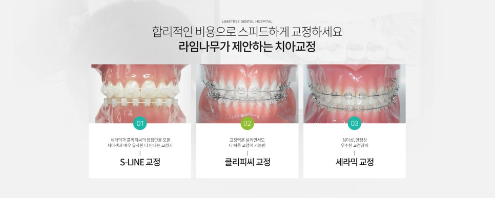 [명동치과] 치아교정 기간? 통증? 교정 궁금증 라임나무치과와 알아보기 관련 이미지 2