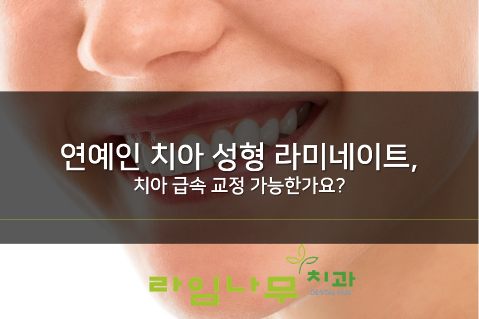 연예인 치아 성형 라미네이트, 치아 급속 교정 가능해요! 명동치과 라임나무치과 관련 이미지 1