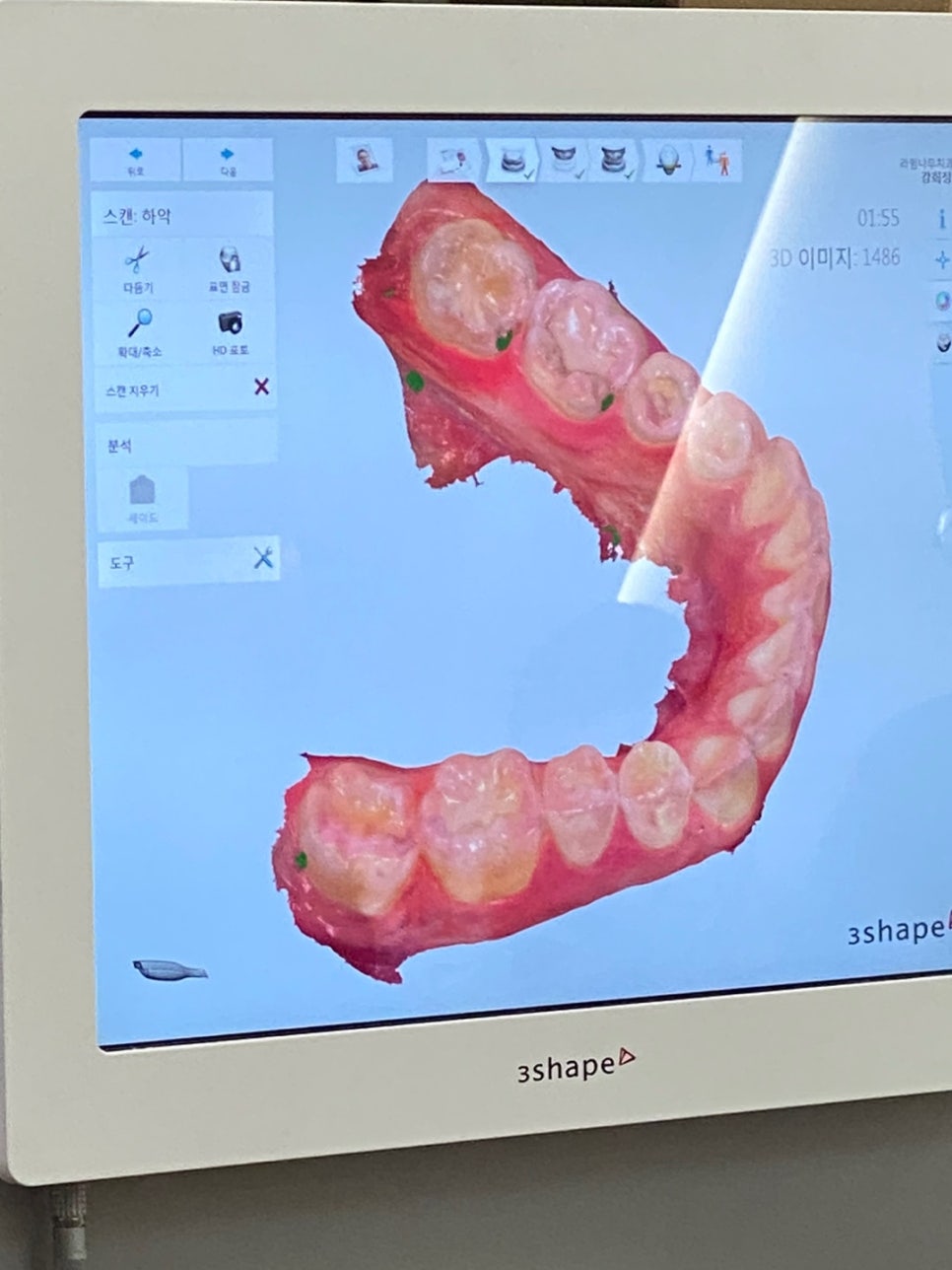 라임나무치과 직원들의 구강스캔대회 후기 관련 이미지 4