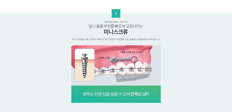 '실버 교정'환자 증가, 언제든지 치아 교정이 가능해요! : 네이버 블로그 관련 이미지 5