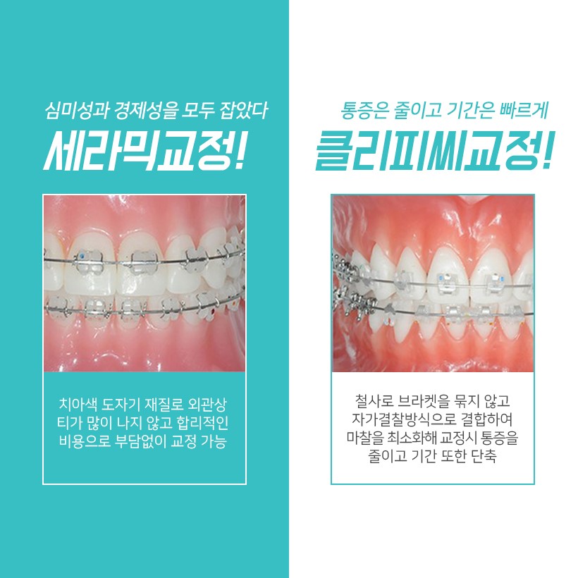 치아교정잘하는곳 눈에 띄어요! 관련 이미지 3