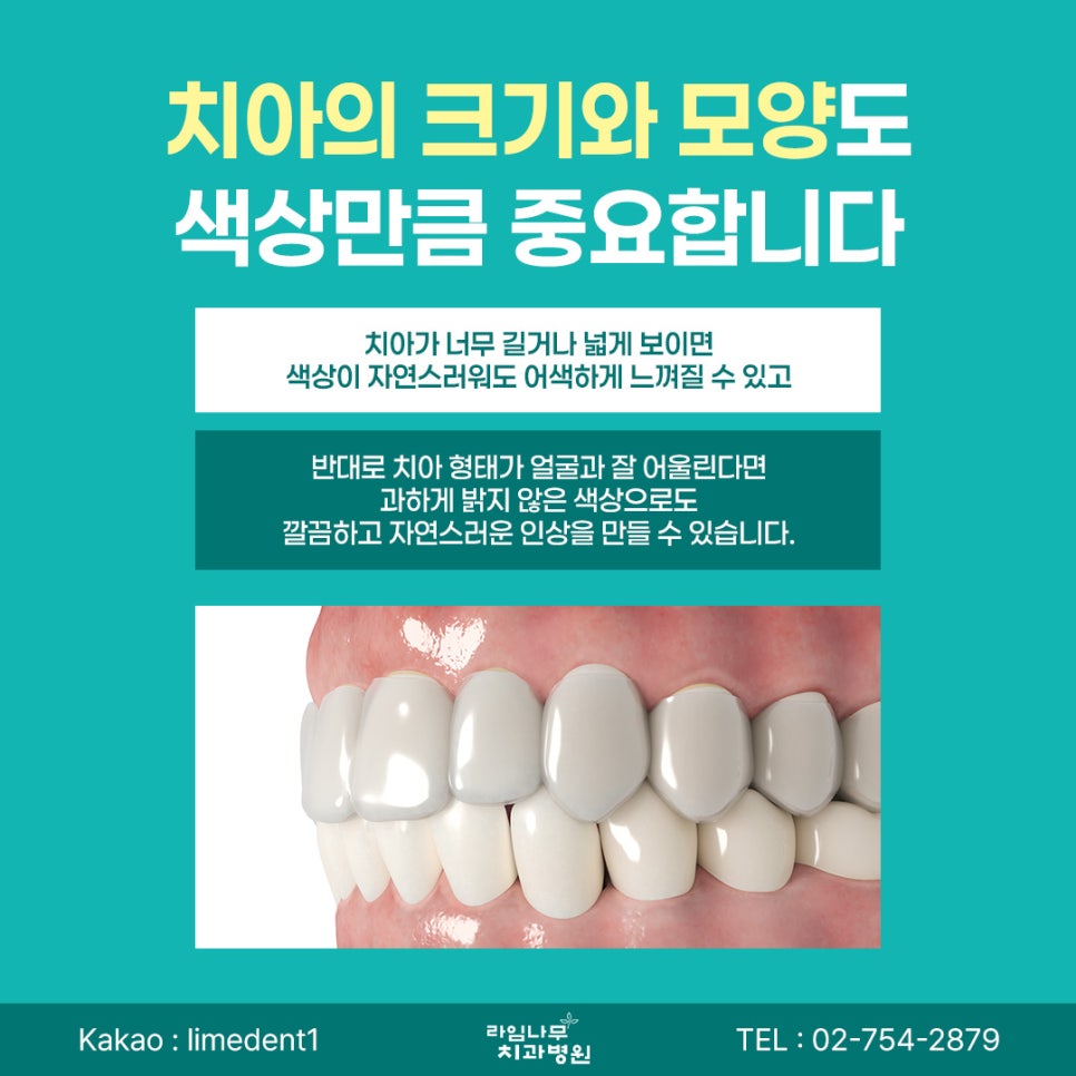 명동 라미네이트 라미네이트, 무조건 하얗게 하면 좋을까요? 자연스러운 색상을 고르는 기준 관련 이미지 6