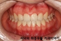 학생교정시 고려할 점은 무엇일까? 관련 이미지 6