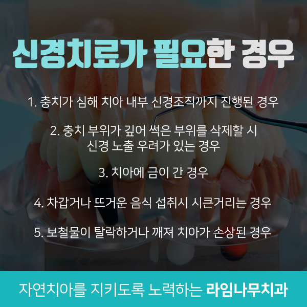 신경치료보다 더힘든 재신경치료, 치과선택은? 관련 이미지 2