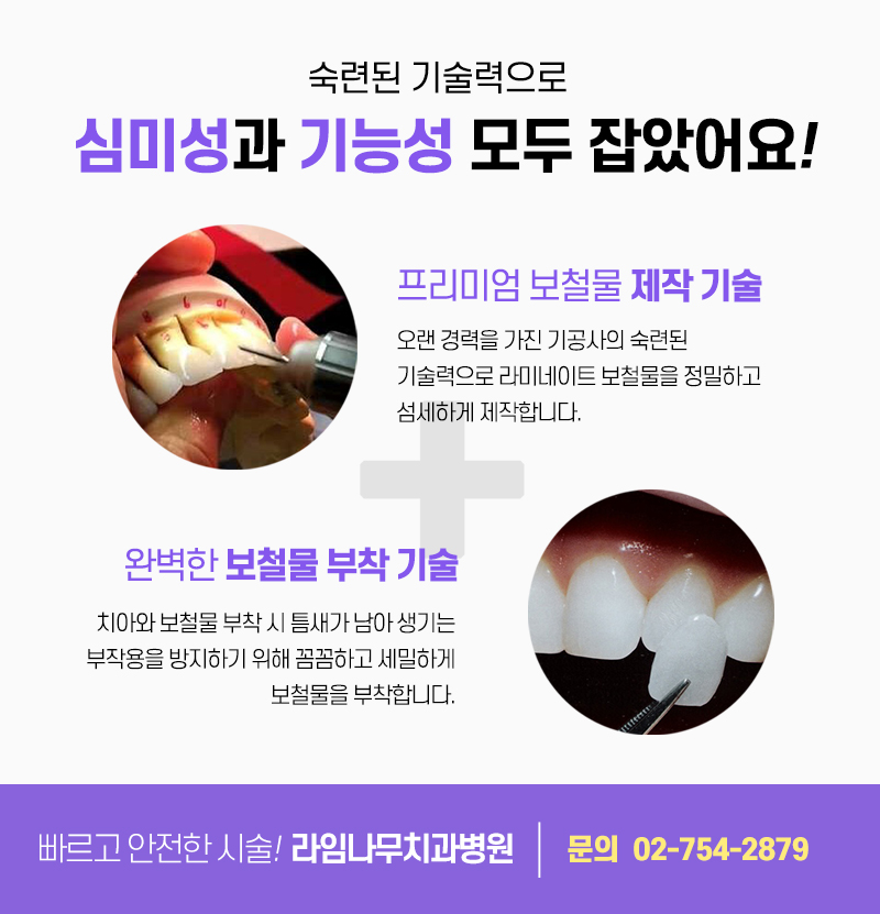 라미네이트 치료, 신중한 결정이 중요합니다 관련 이미지 4