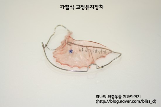 치아교정 궁금증 해결 – 그것이 알고 싶다 관련 이미지 4