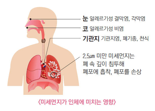 [명동치과]황사와 미세먼지의 차이, 알고 대처해야 합니다 관련 이미지 4