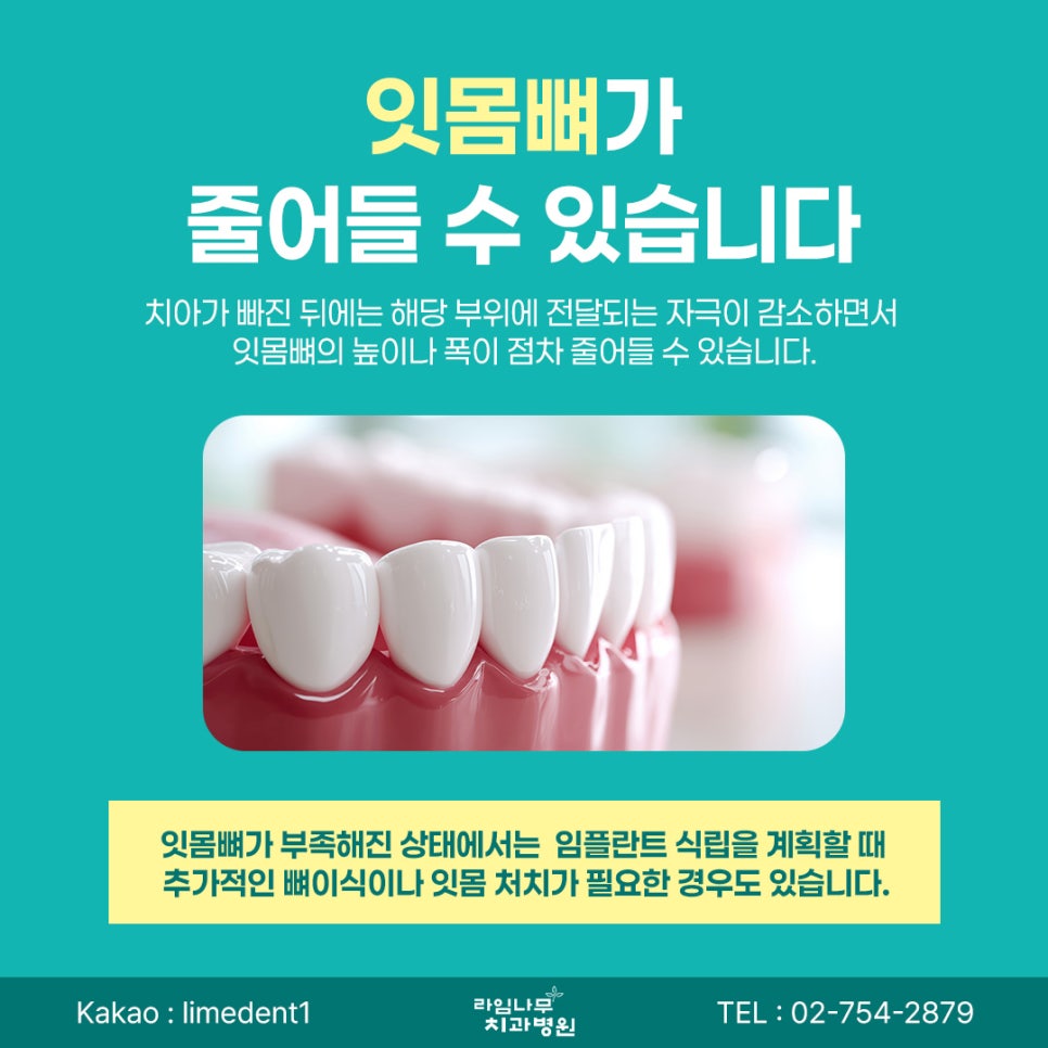 Myeongdong Dental Implants: Can Leaving a Missing Tooth Untreated for a Long Time Affect the Surrounding Teeth? image 5