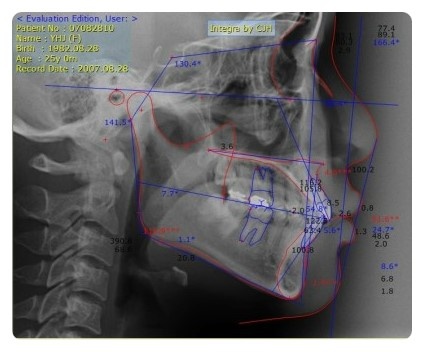 치아교정 궁금증 해결 – 그것이 알고 싶다 관련 이미지 3