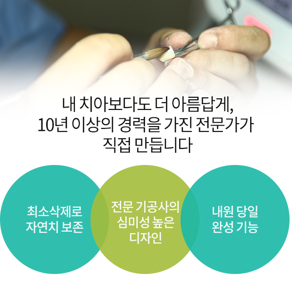 치아사이벌어짐, 라미네이트? 부분교정? 선택은! 관련 이미지 3