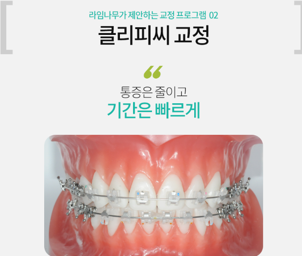 치아교정 장치 종류 (세라믹,클리피씨,에스라인교정) 관련 이미지 5