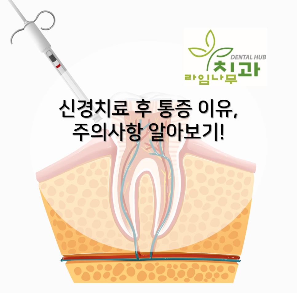 [명동치과] 신경치료 후 통증 이유와 주의사항 알아보기! 관련 이미지 1