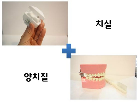 치주질환 예방 양치질만으로 가능할까? 관련 이미지 3