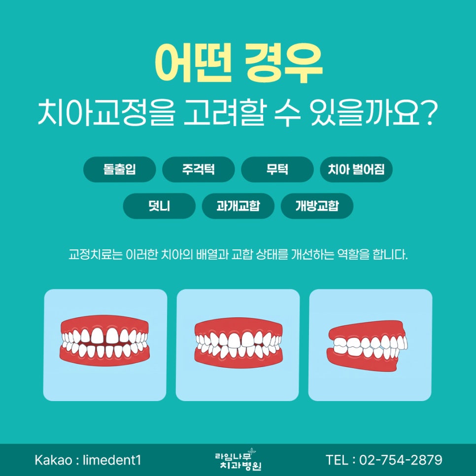치아교정 시작 전, 알아둬야 할 체크포인트 관련 이미지 3