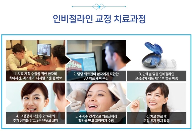 투명교정 인비절라인으로 티 안나게 교정하세요 관련 이미지 4