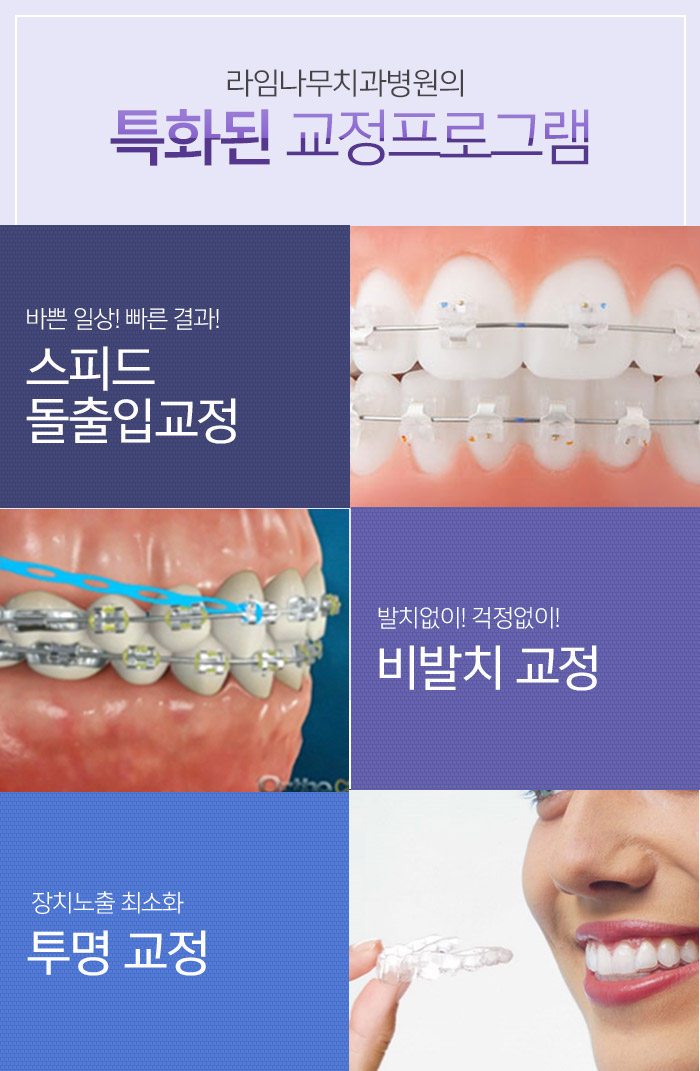 만족스러운 치아교정을 위한 사전 체크포인트 관련 이미지 6