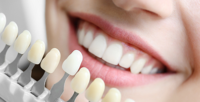 [라임나무치과] 키스데이에 알아보는 입냄새 제거법과 예방법! 관련 이미지 7