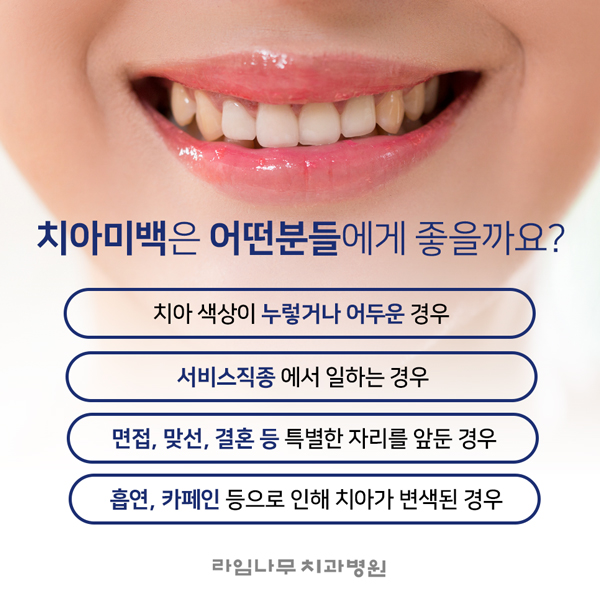치아미백종류 환한 미소 기대해도 좋아 관련 이미지 2