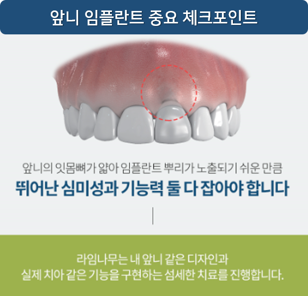 앞니 임플란트 후기 티나지 않아요 명동치과 라임나무 관련 이미지 2