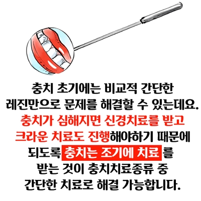 [충치치료종류] 충치치료 언제까지 참으실건가요?? 관련 이미지 8
