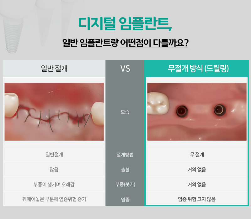 을지로입구치과 라임나무치과에서 임플란트 하세요 관련 이미지 8