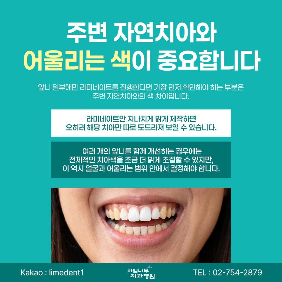 명동 라미네이트 라미네이트, 무조건 하얗게 하면 좋을까요? 자연스러운 색상을 고르는 기준 관련 이미지 3