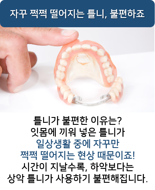 명동치과 만족도 높은 임플란트 틀니 알아보기! 라임나무 관련 이미지 2