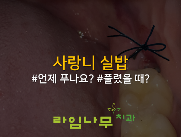 사랑니실밥 언제푸나요? 풀렸을때? 명동치과 라임나무 관련 이미지 1