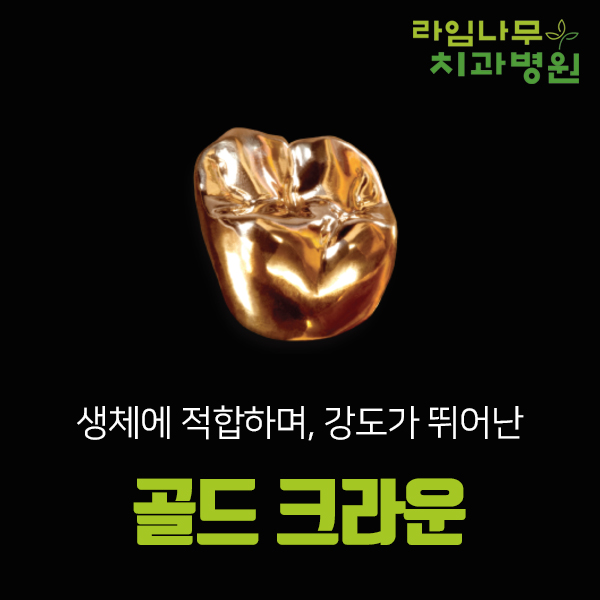 명동치과, 지르코니아 vs 금 ? 관련 이미지 3