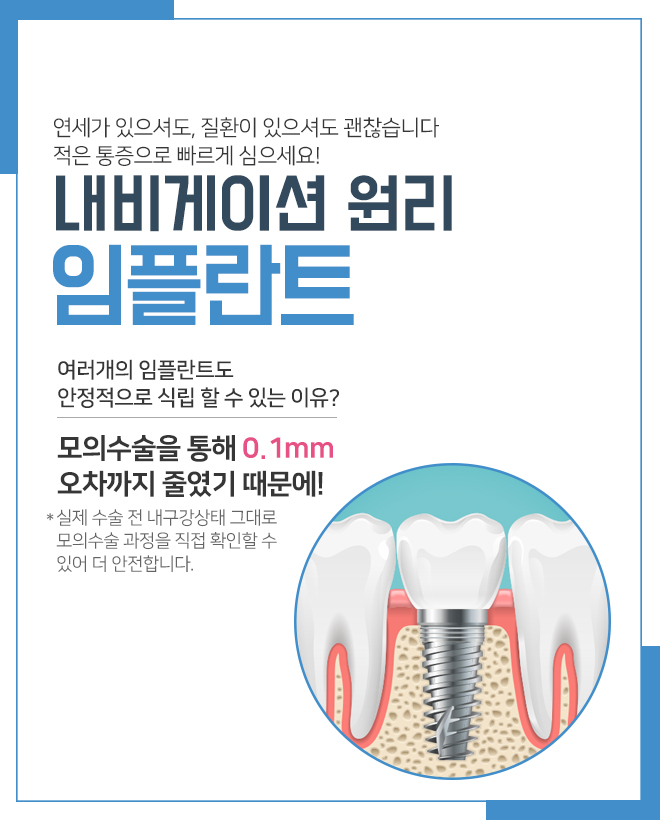 라임나무치과에서 부담 덜어낸 임플란트 받아보세요 관련 이미지 6