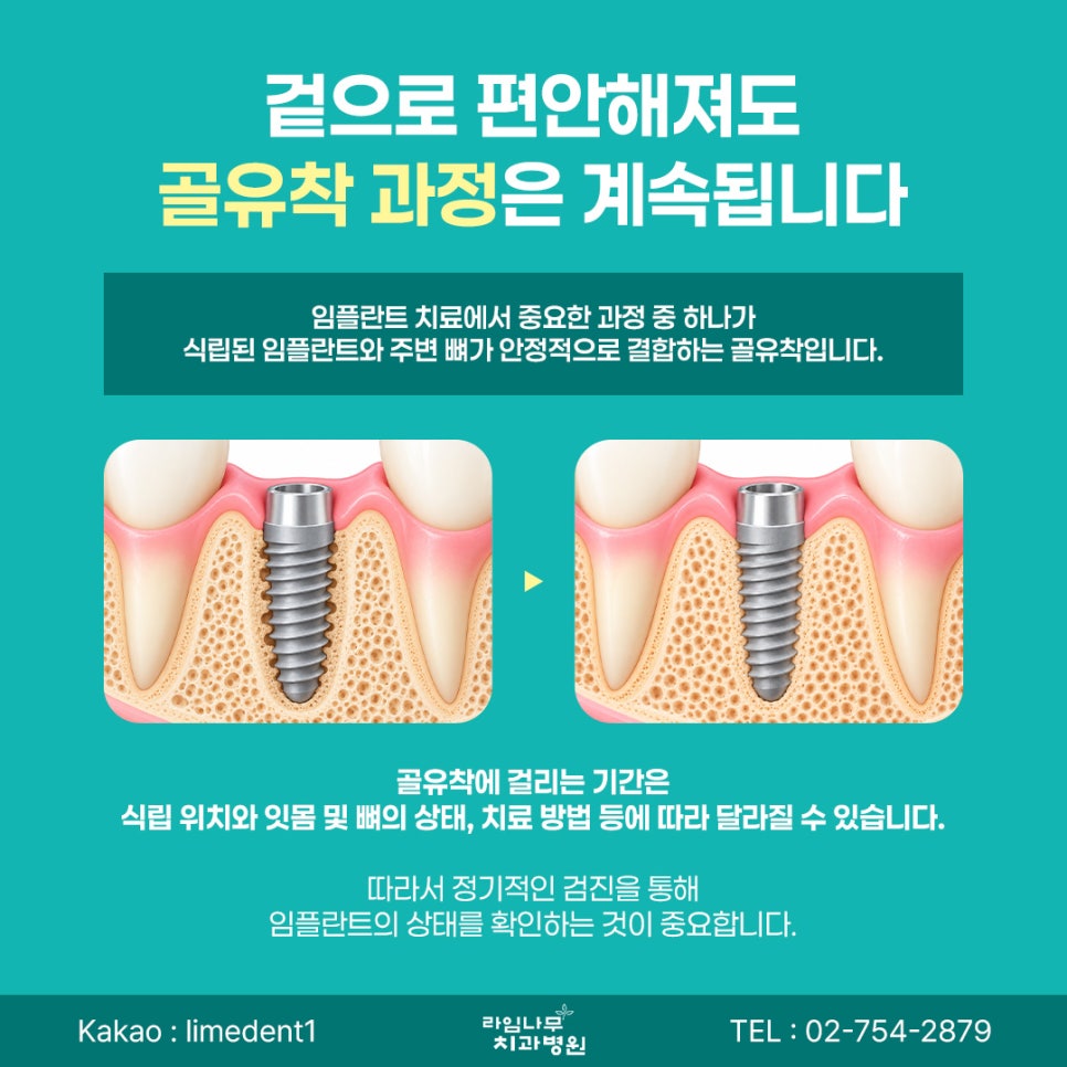 명동 임플란트 후 음식은 언제부터 편하게 먹을 수 있을까요? 회복 단계별 관리 방법 관련 이미지 6